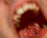 beeldvergroting: 2162